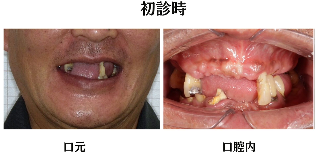 初診時の症例画像