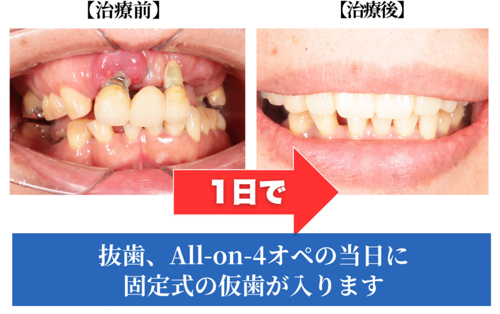 治療前と治療後の画像
