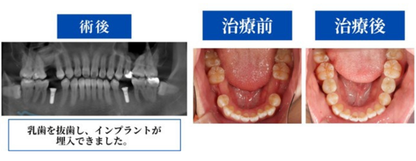 BeforeAfter症例画像