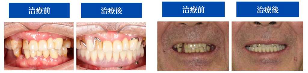 治療前後の見た目BeforeAfter