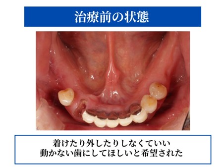 治療前の状態