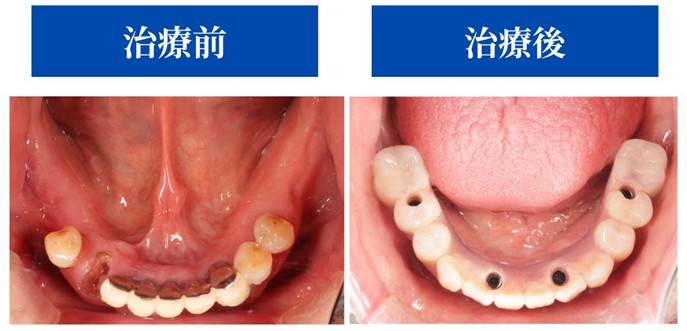 治療前後の症例画像