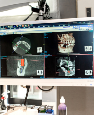 専任の「インプラントカウンセラー」