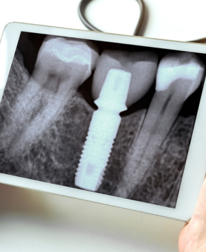 安心の「10年保証」