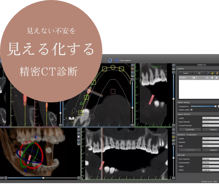 精密なCT撮影