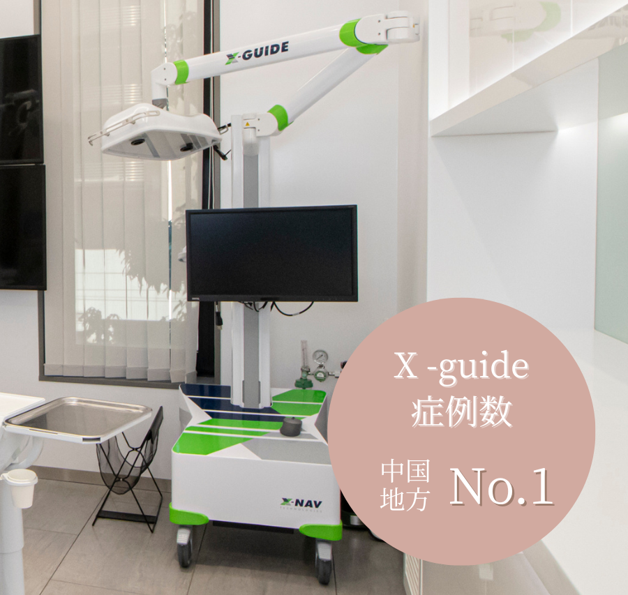 X-guide