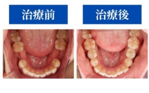BeforeAfter症例画像